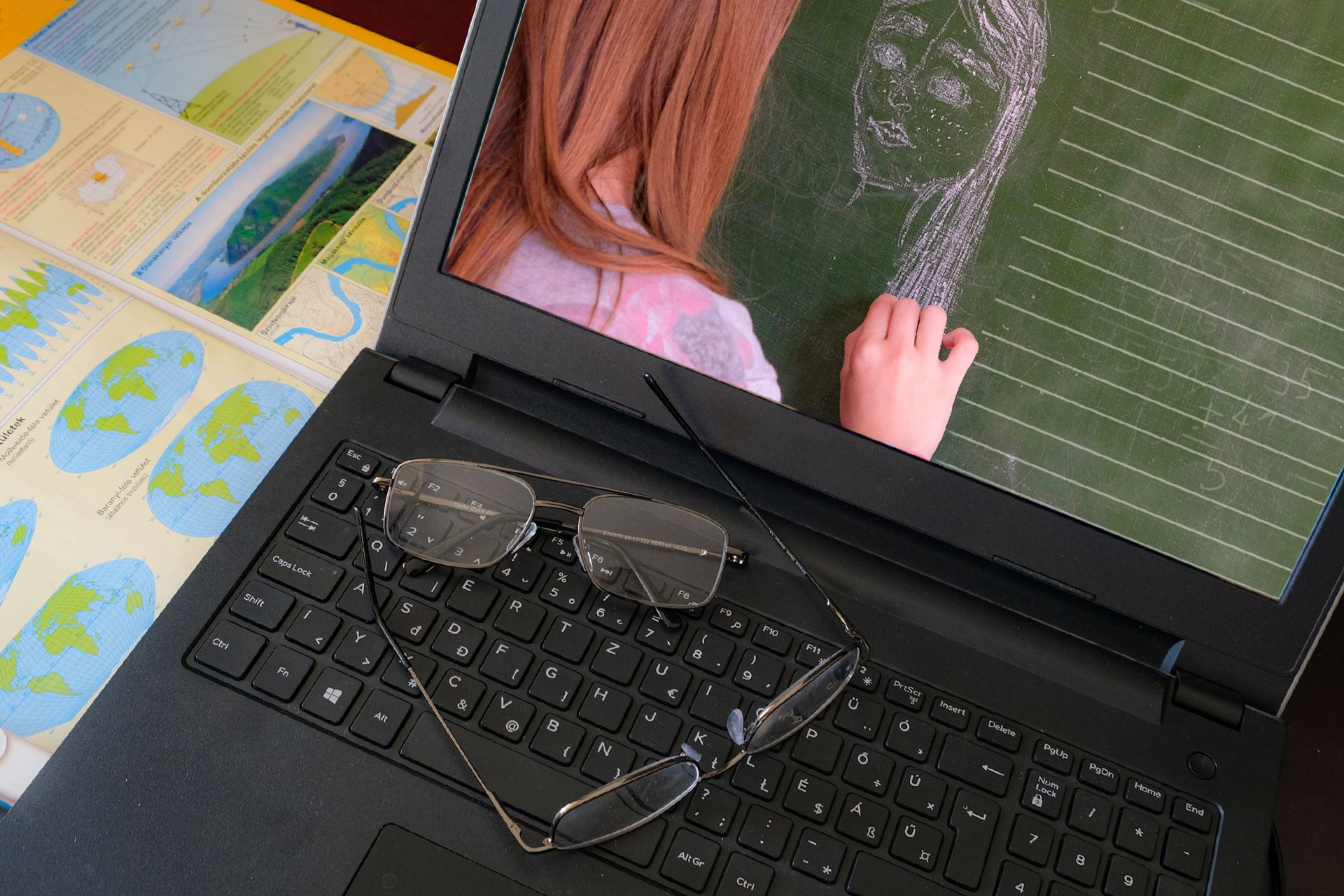 Hunyorít, mellényúl, félrelép? Lehet, hogy ez lusta szem! 